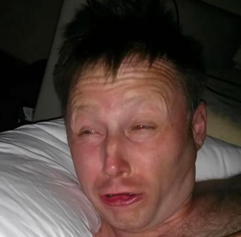 A white man squinting very hard at a bright light in bed. He seems very confused
