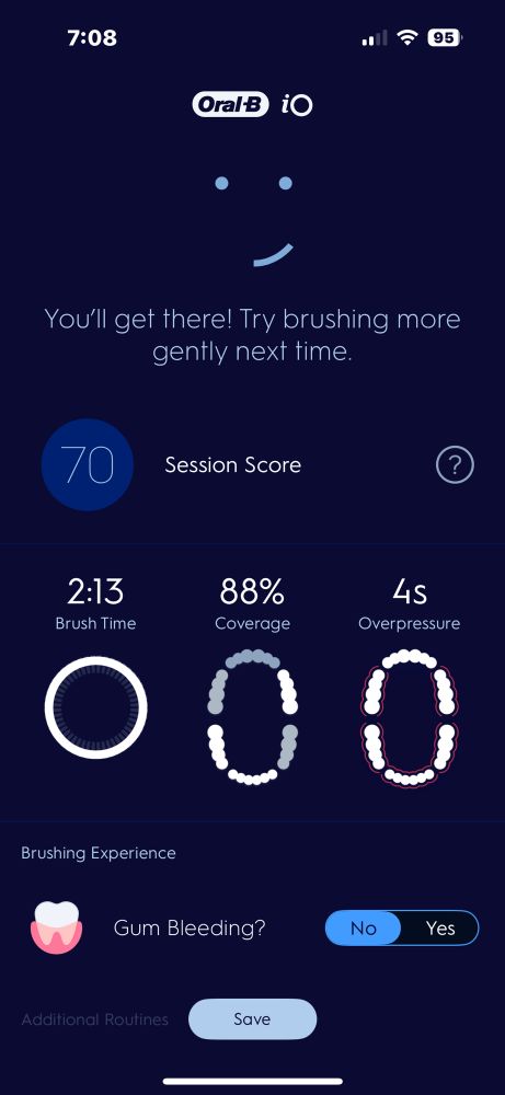 Screenshot of my OralB score showing such things as how long I used too much pressure (4 seconds), how much coverage I got with my brushing (88%), and for how long I brushed (2:13).