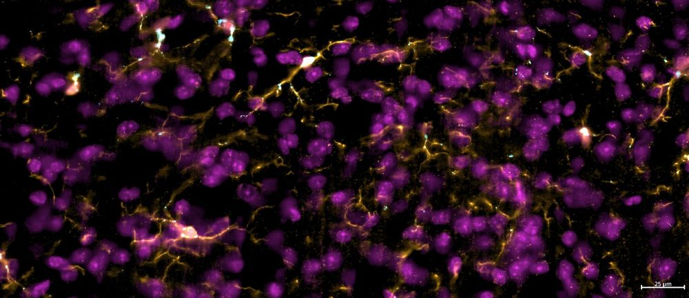 Zoomed in Immunofluorescence image from the full mouse brain slice, with nuclei (magenta) and microglia (orange) shown.