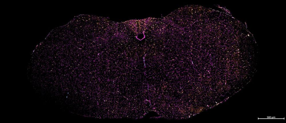 Immunofluorescence image of a mouse brain slice, with nuclei (magenta) and microglia (orange) shown.