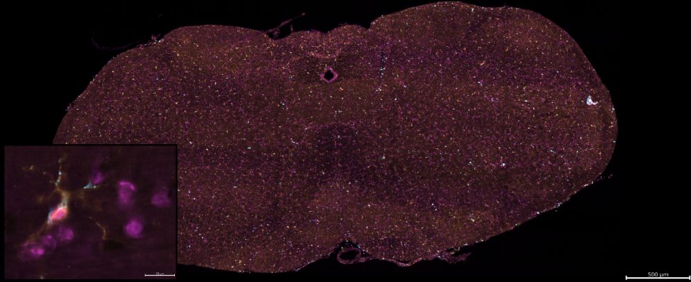 Adaptive optics oblique plane microscopy of 100 um thick mouse brain slice with immunofluorescence.