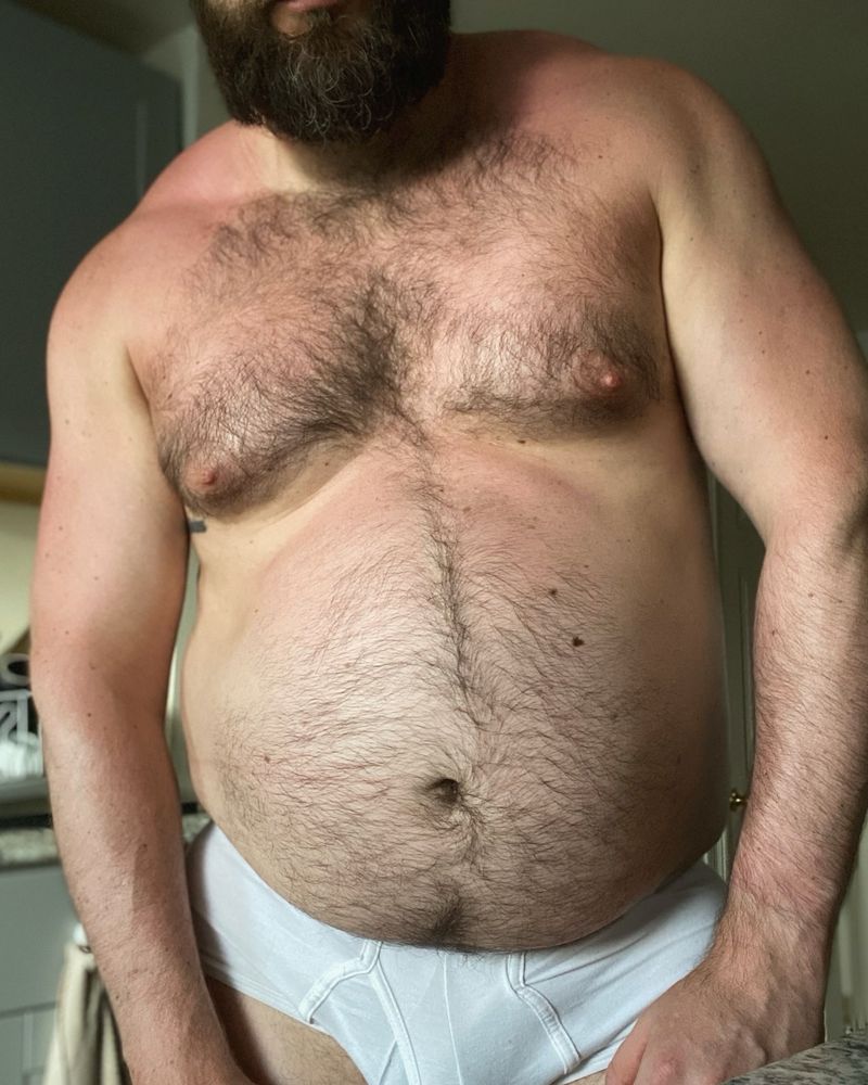 Man with sunburn showing off his big fat belly while flexing his muscles in white underwear.