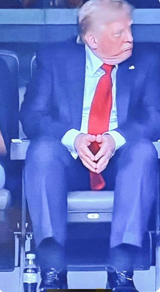 Picture of Donald Trump (attending FIFA soccer match on Sunday?) with severely swollen cankles—not to mention his grotesque chin-neck. 