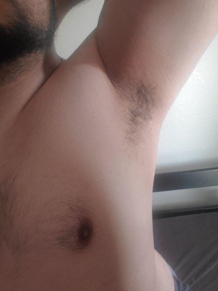 A picture of CelySenpais pits