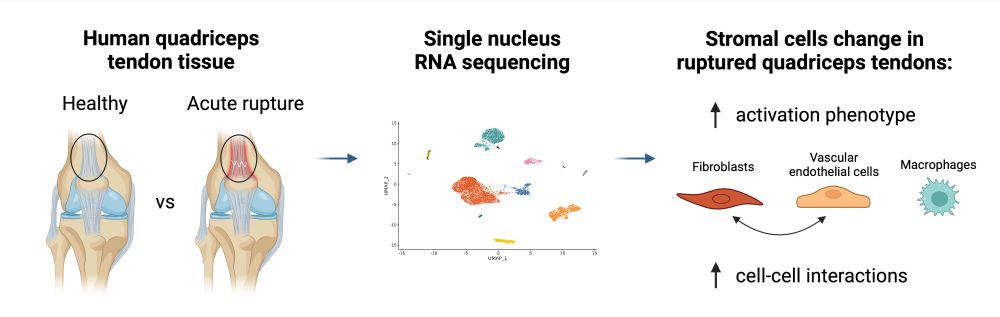 This Graphical abstract depicts healthy and acutely ruptured human quadriceps tendons. Using single nucleus RNA sequencing, the analysis shows that stromal cells change in ruptured quadriceps tendons, including increase of activated phenotype of fibroblasts, vascular endothelial cells, and macrophages, as well as increase in cell-cell interactions between fibroblasts and vascular endothelial cells.