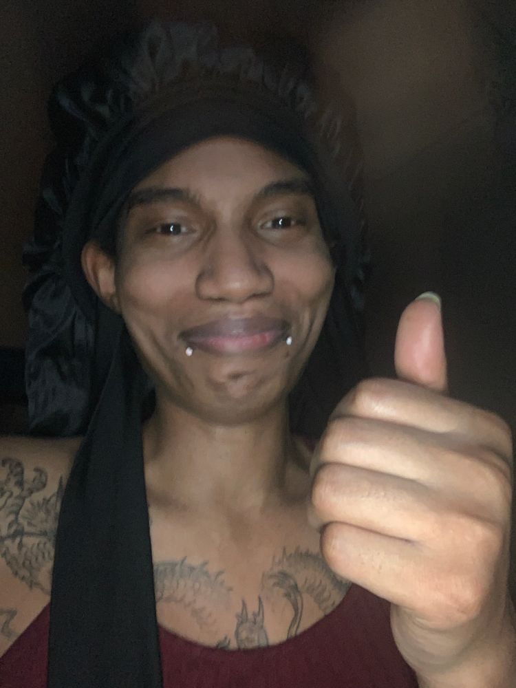 Tuesday smiling with cracked dried lips with a thumbs up 