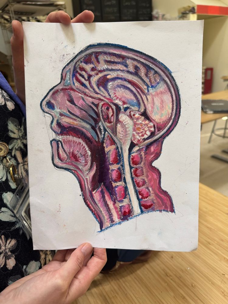 A semi-realistic drawing of a severed cadaver head, done in oil pastels 