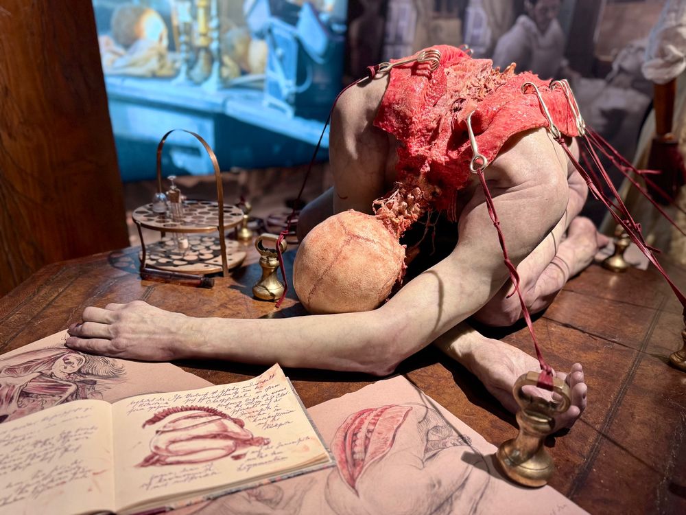 A cadaver kneeling forwards on a table, its head lowered with its left arm extending beyond, its right underneath its body. The head is a skull, the body’s spine is open with hooks holding the flesh apart.