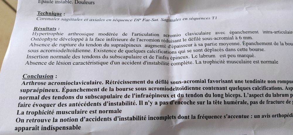 Epaule instable. Douleurs

Technique:

Coronales sagittales et axiales en séquence DP Fat-Sat. Saginales en séquences TI

Résultats :

Hypertrophie arthrosique modérée de l'articulation acromio claviculaire avec épanchement intra-articulaire Ostéophyte développé à la face inférieure de l'acromion réduisant le défilé sous-acromial à 6 mm.

Absence de rupture du tendon du supraépineux augmenté d'épaisseur à sa partie moyenne. Épanchement de la bou sous acromiodeltoidienne. Existence de quelques calcifications qui se sont déplacés dans cette bourse.

Insertion normale des tendons du subscapulaire et de l'infra épineux. Le labrum est peu marqué. Absence de lésion caractéristique d'un accident d'instabilité complète. La trophicité musculaire est normale

Conclusion:

Arthrose acromioclaviculaire. Rétrécissement du défilé sous-acromial favorisant une tendinite non rompue supraépineux. Épanchement de la bourse sous acromiodeltoïdienne contenant quelques calcifications. Asp normal des tendons du subscapulaire de l'infraépineux et du tendon du long biceps. L'aspect du labrum p faire évoquer des antécédents d'instabilité. Il n'y a pas d'encoche sur la tête humérale, pas de fracture de

La trophicité musculaire est normale

On retrouve la notion d'accidents d'instabilité incomplets dont la fréquence s'accentue: un avis orthopédi apparaît indispensable