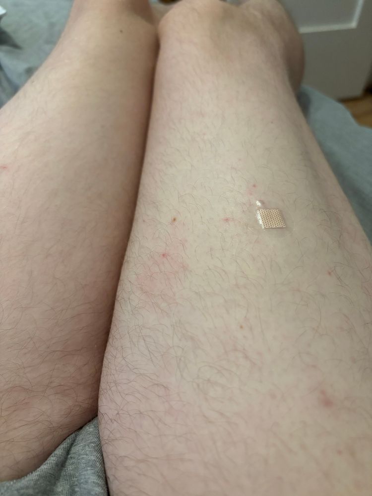 Bandaid over right leg injection 