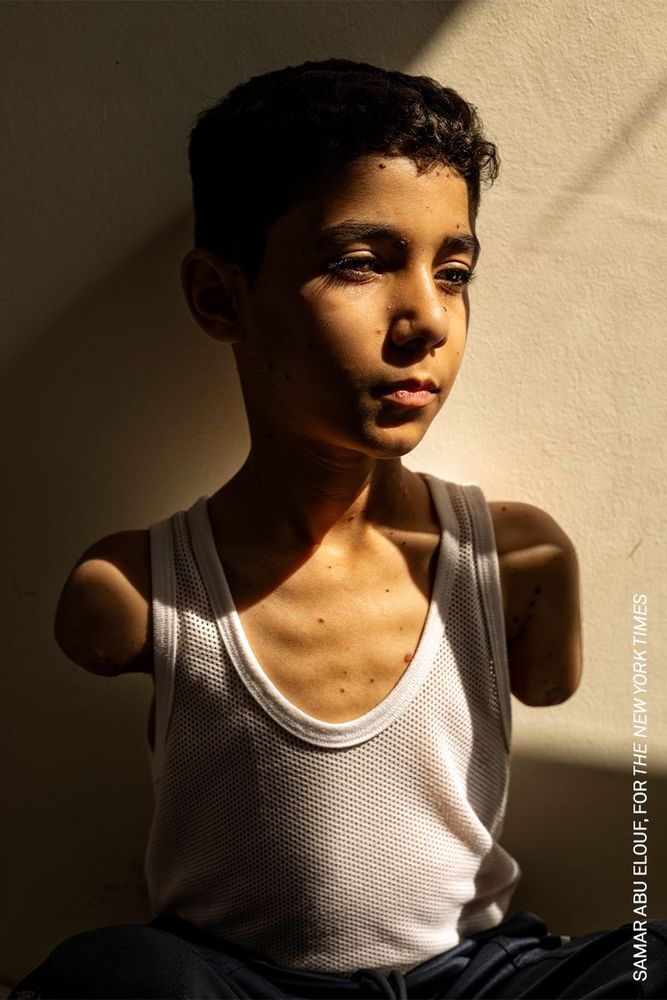Mahmoud Ajjour, who was critically injured while fleeing an Israeli attack in Gaza City in March 202, in an image captured by Doha-based Palestinian photographer Samar Abu Elouf for The New York Times
