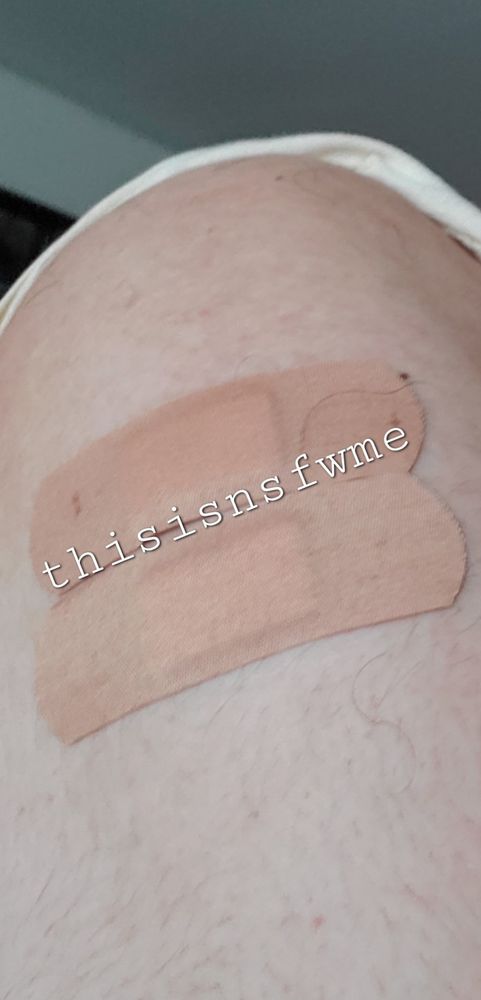 Shoulder with 2 bandages with text that reads thisisnsfwme 