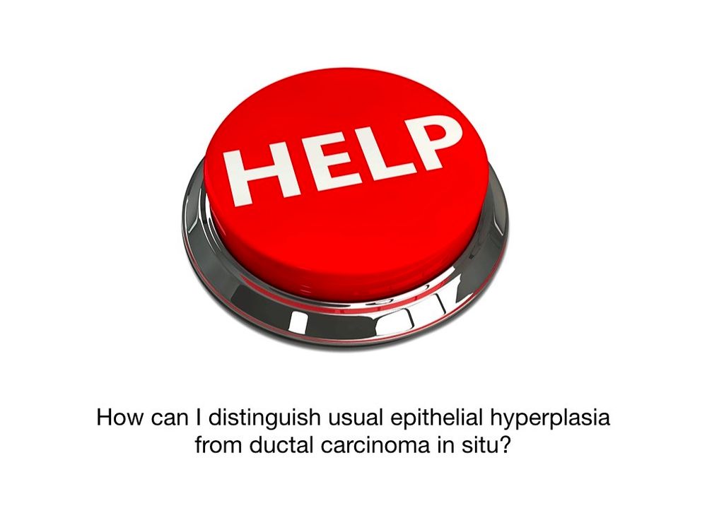 Help button title slide - DCIS Vs UEH 