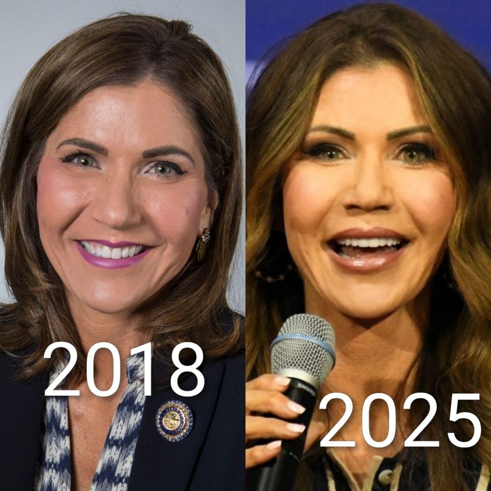 composite image of 2 photos side-by-side of Kristi Noem's original face from 2018 and the 2025 plastic allergy face so many Trumpy women have forced on themselves 