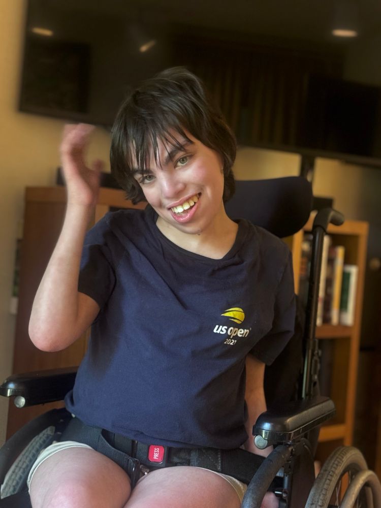 A smiling kid in a wheelchair with a facial features associated with cri du chat syndrome