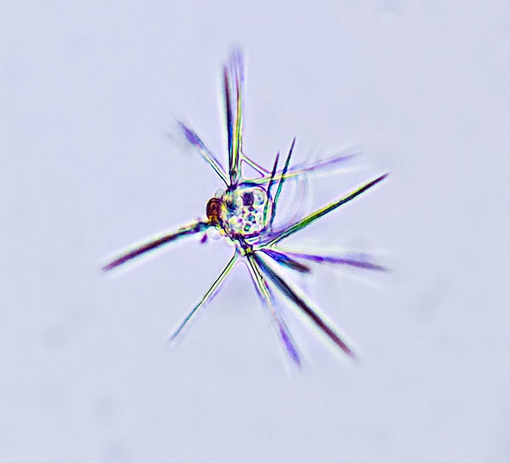 An image of the microscopic radiolarian Plagiacantha arachnoides from the gulf of Maine. It is largely absent from the water column except during the period Late July-Mid October. 