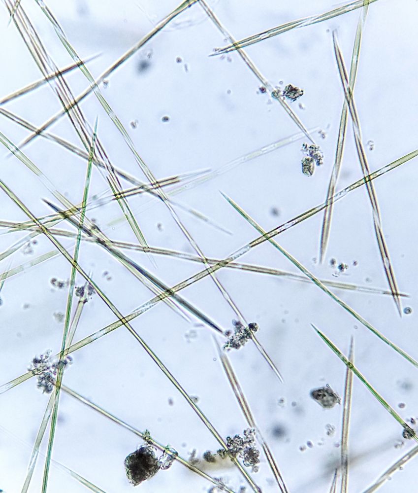 Plankton sample through a microscope filled with diatom chains that look like little sticks.