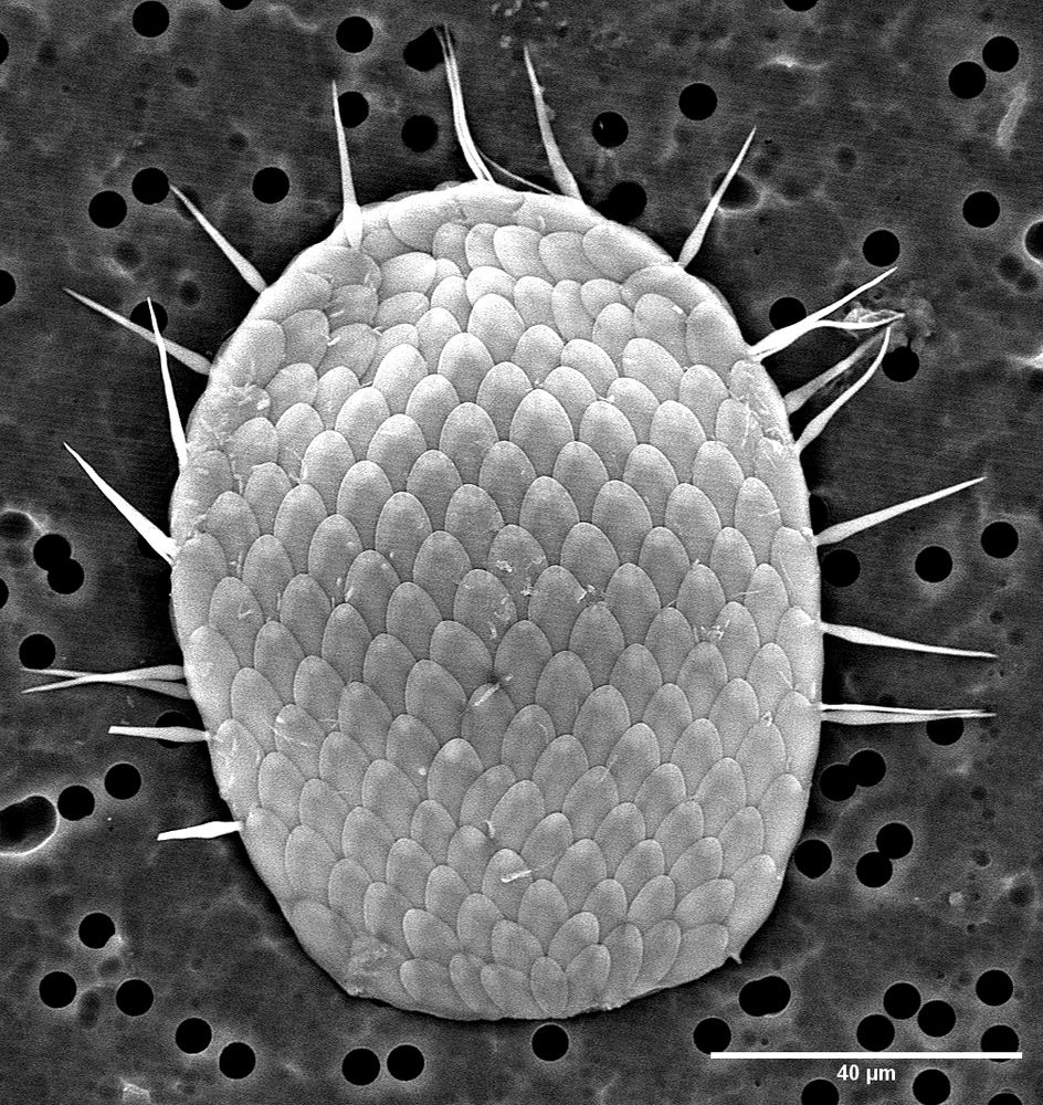 SEM image of a rhizarian testate amoeba (euglyphid) showing its glass scales.