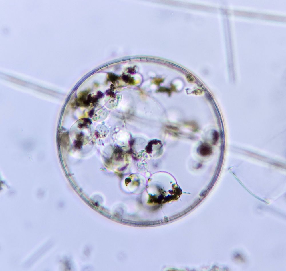 A diatom (coscinodiscus) whose cytoplasm is contracted into connected spheres. Reminds me of depictions of the multiverse. 