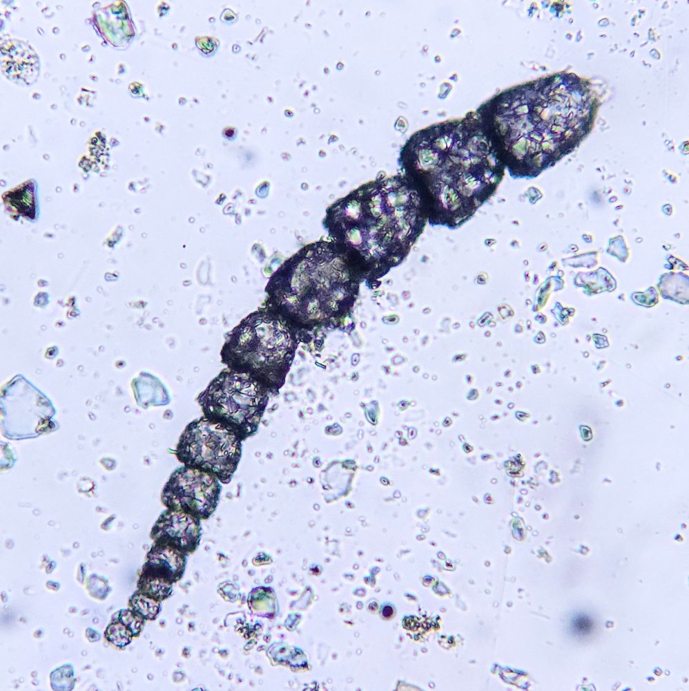 Chain-shaped shell of a benthic foraminiferan from marine sediments. 