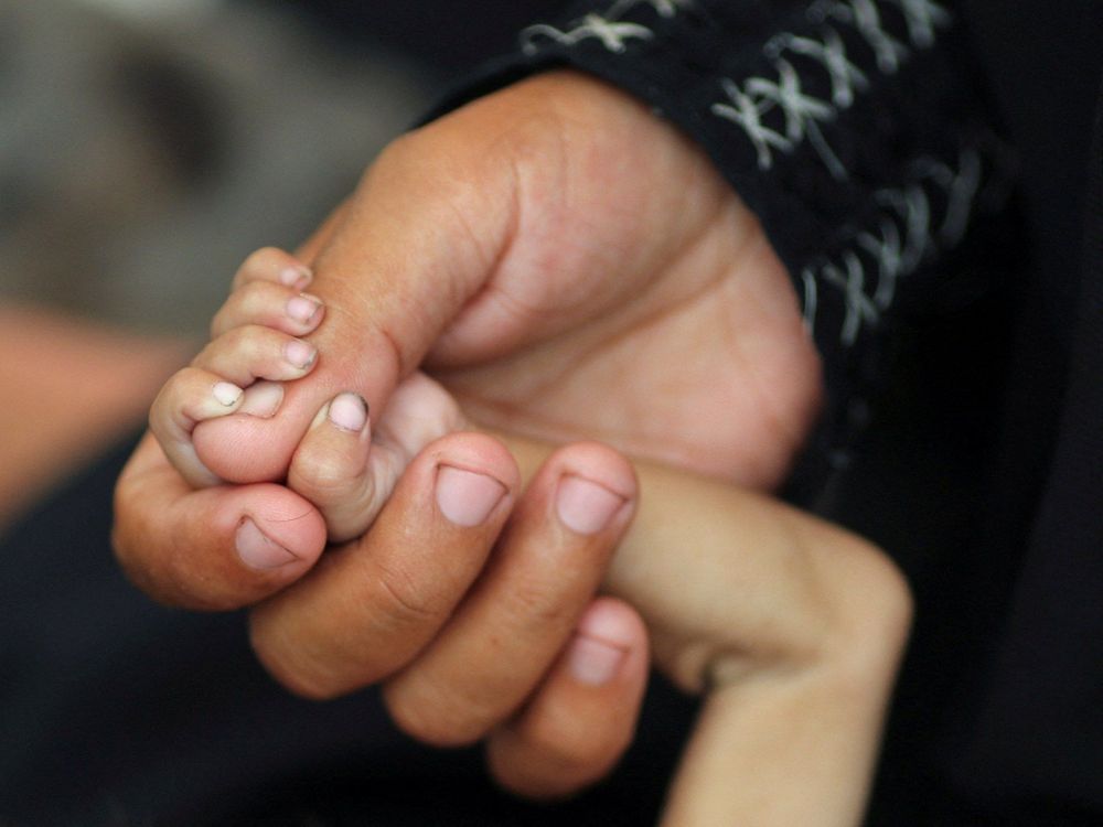 Two children died of starvation on Thursday, as WHO warns 12,000 children aged under five suffering acute malnutrition.