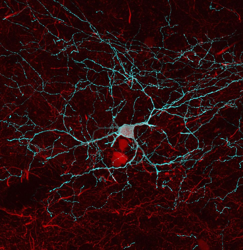 Neurons in the brain.