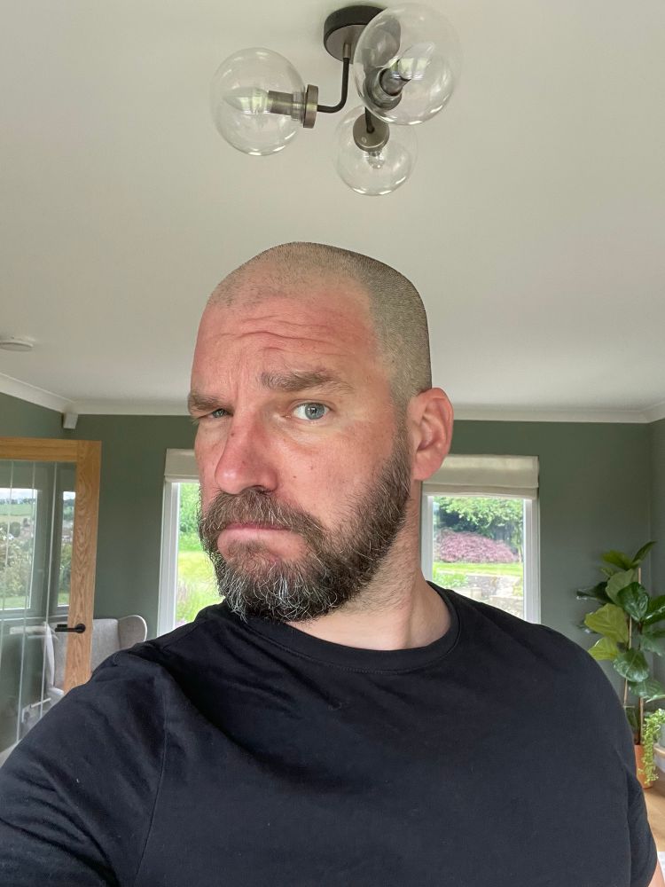 Man with shaved head