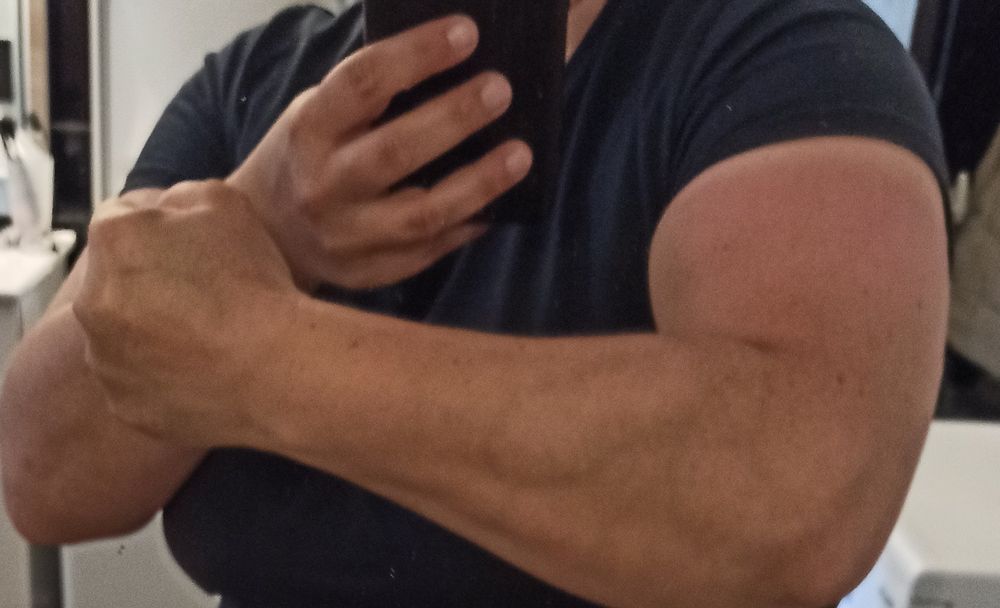 Bout de torse d'une femme en t-shirt (moi) dont on voit un bras plié, muscles contractés.