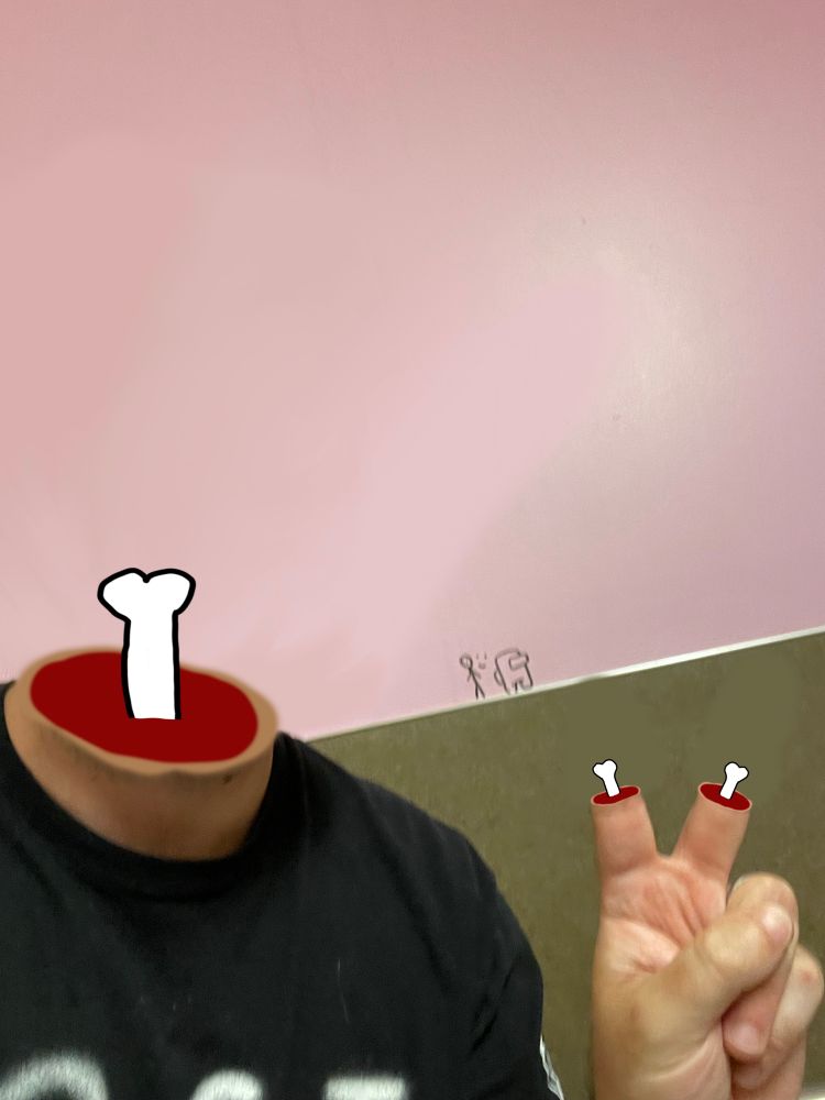 An edit of an edit of the original image of me in front of the wall with the stick figure and Among Us guy drawn on it, with the cartoon bone sticking out of my neck stump and also the fingers for the peace sign I’m giving have been also been sliced of with the cartoon bone sticking out of the two finger stumps