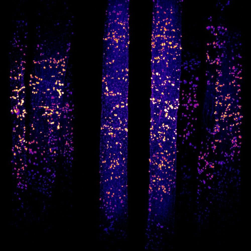 This image shows long purple columns on a black background with pink and orange spots shining along them. 