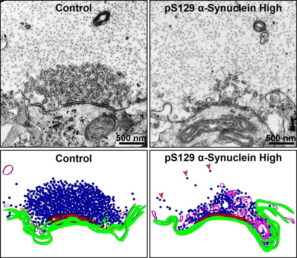 Side-by-side TEM images and 3D reconstructions of lamprey synapses. Control shows dense synaptic vesicles and organized structure; high pS129 alpha-synuclein shows dispersed vesicles and disrupted architecture.