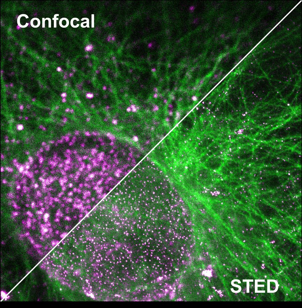 Split image comparing confocal and STED microscopy of a cell. The left half (labeled "Confocal") shows a blurrier image with magenta and green signals—magenta representing nuclear pore complexes in the nucleus, and green showing the vimentin cytoskeleton. The right half (labeled "STED") displays the same structures with much sharper definition and finer detail, highlighting the improved resolution of STED microscopy.