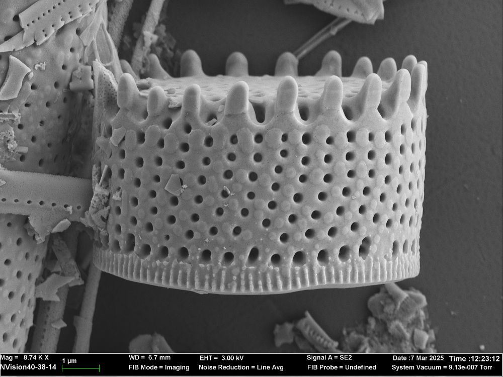 In the center of this grayscale image is a microscopic organism that looks like a crown. The base of the image details the settings on the electron microscope that the image was taken on. 