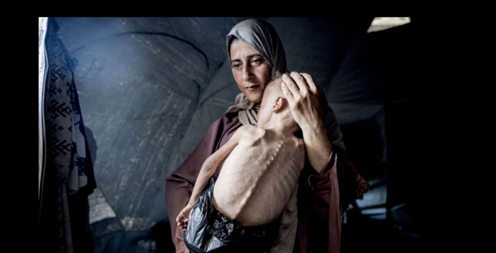 A Getty image of an emaciated Palestinian child in the arms of her mother