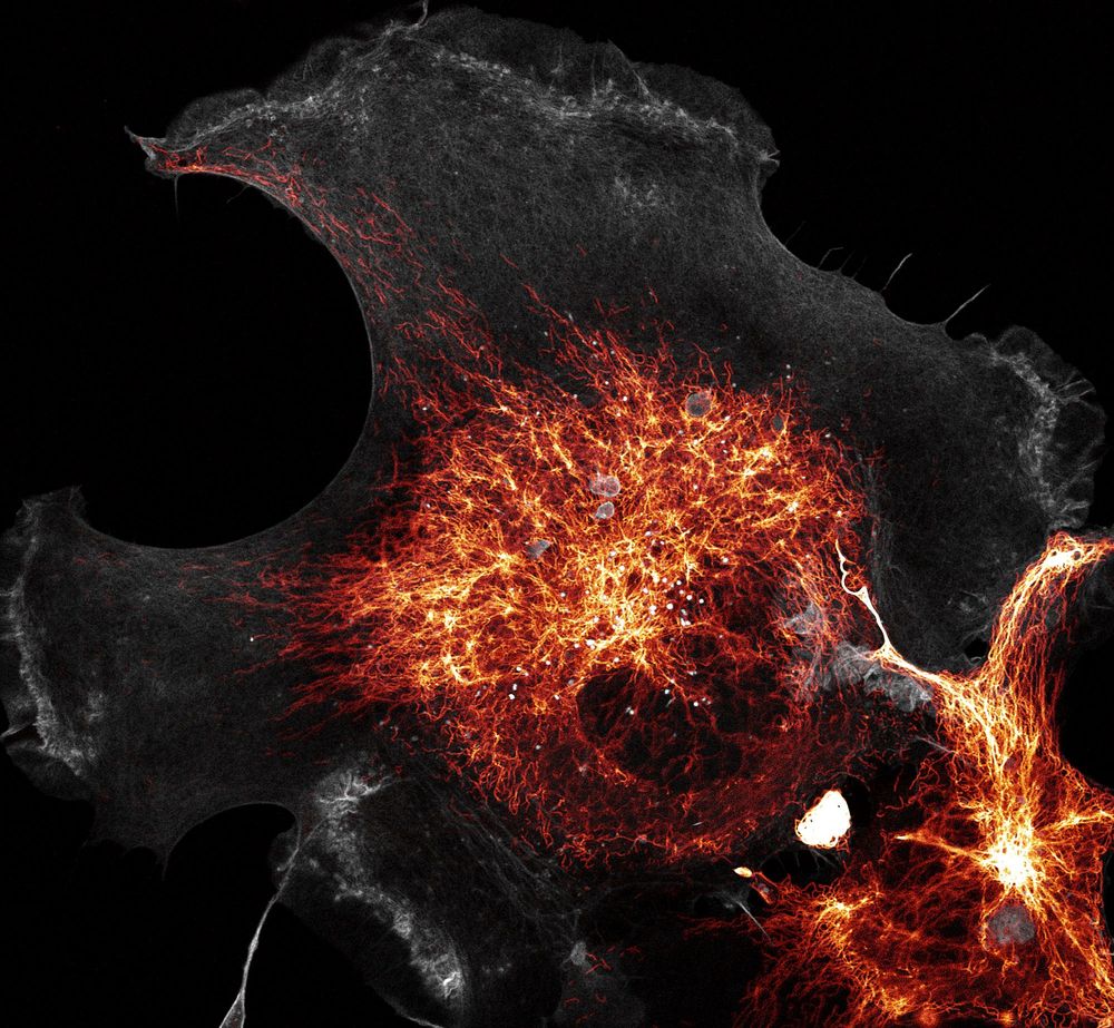 Endogenously tagged vimentin-mEmerald (orange) and F-tractin-mCherry (actin filaments, gray) in a live COS-7 cell imaged with Airyscan microscopy. 