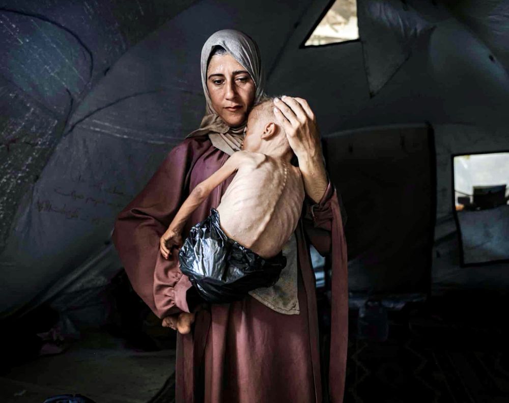 Palestinian mother holding starving small child 