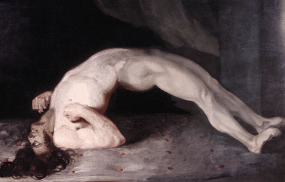 Painting by Sir Charles Bell depicting opisthotonos, which can be caused by tetanus (1809)