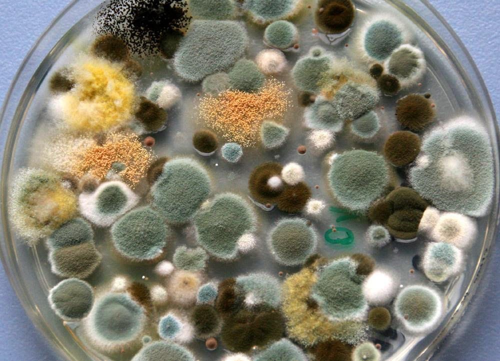 A Petri dish of molds. Kinda gross, but preferable to the brotriarchy culture currently spreading toxic spores throughout the world.