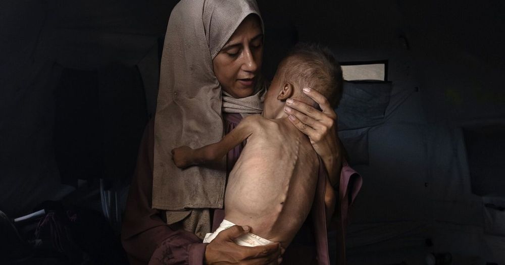 Stop the starvation of the people of Gaza | Editorial