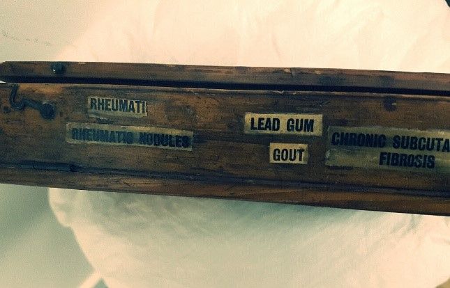 The side view of a small wooden case with labels of named diseases.