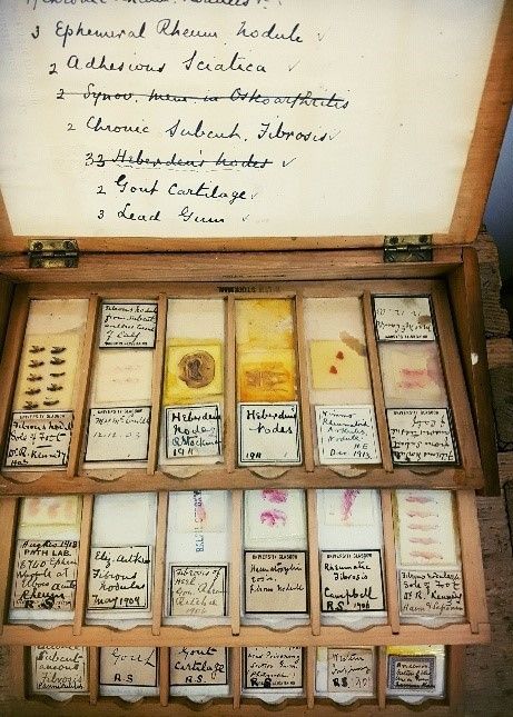 A small wood cabinet with drawers opened displaying labelled microscopic histology slides of tissue preparations. 