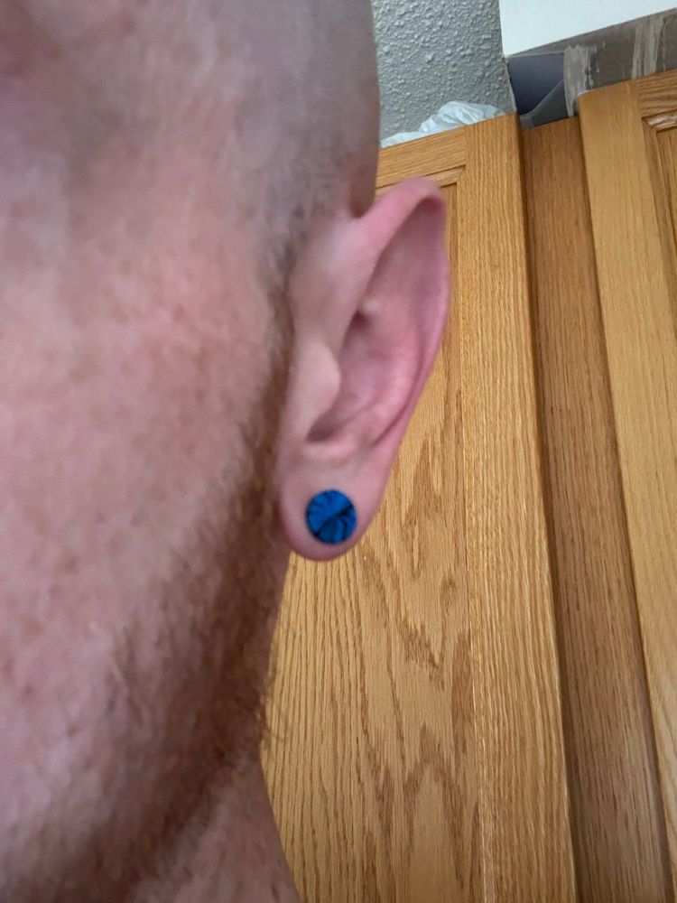 My huge ear, with a large stud earring. The pattern is blue and black swirls. 