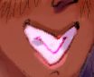Closeup of Vincent's mouth, with a big smile that shows off his buck teeth