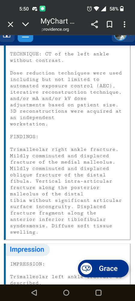 Trimalleolar break. Oblique fractures of the tibia and fibula and a vertical intra-articular fracture of the distal tibia plus a rogue fragment. 