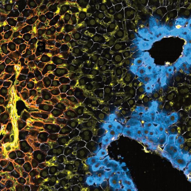 Immunostaining of liver tissue.