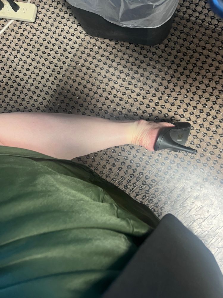 A view of a white leg, a green skirt, and a black heel. 