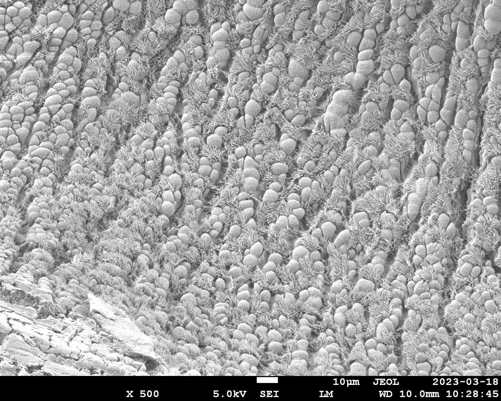 Zooming out even further, we see rows of cells making up the inner lining of the wind pipe