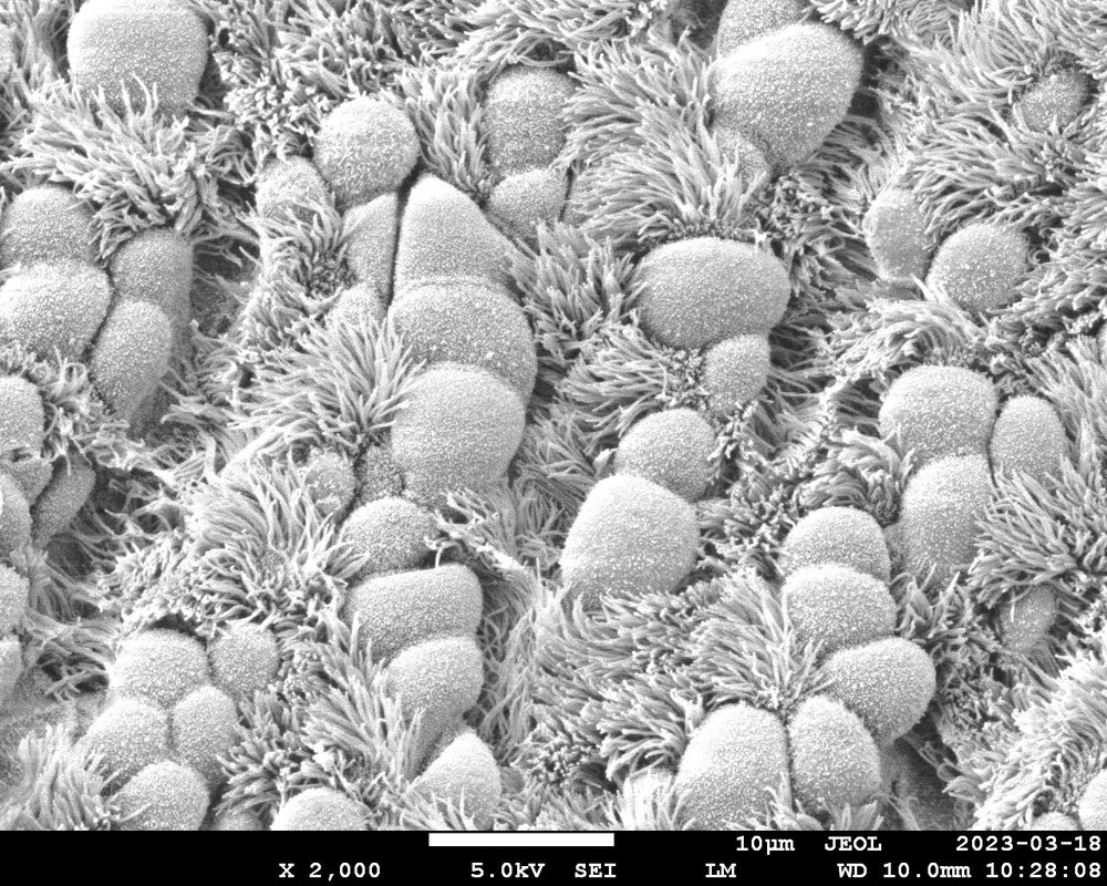 Zooming out. We see more of the cilia. It looks like a long-hair carpet!