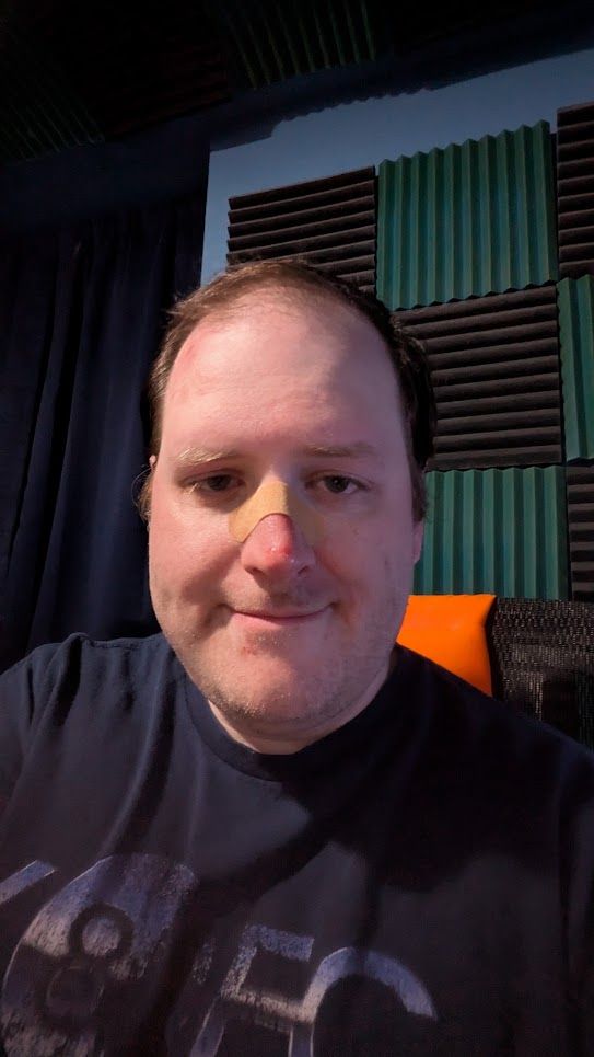 A selfie of Linkara, who now has a band-aid on his nose along with some bruised/scraped skin.