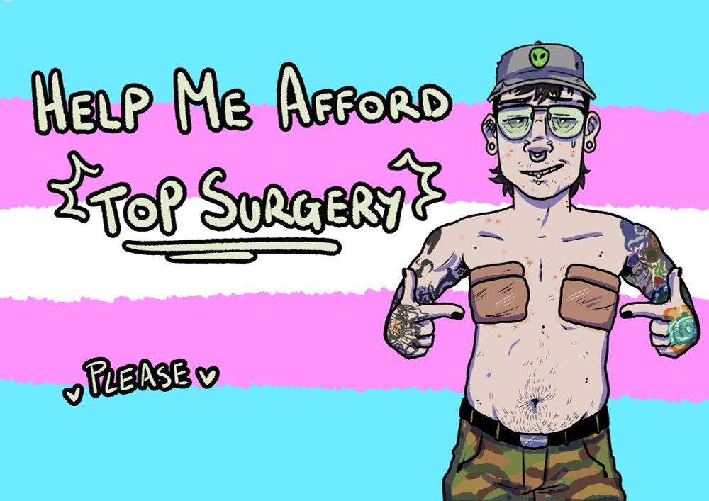 Top Surgery donation post featuring trans man with tape binding